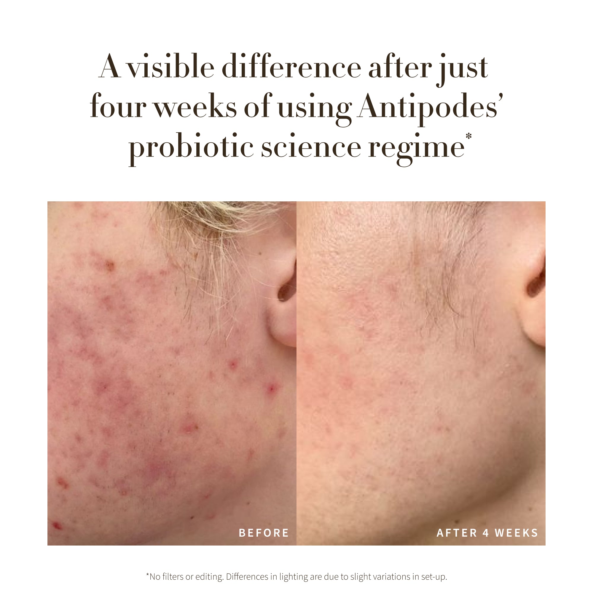 Credo Probiotic Anti-Blemish Serum 30ml